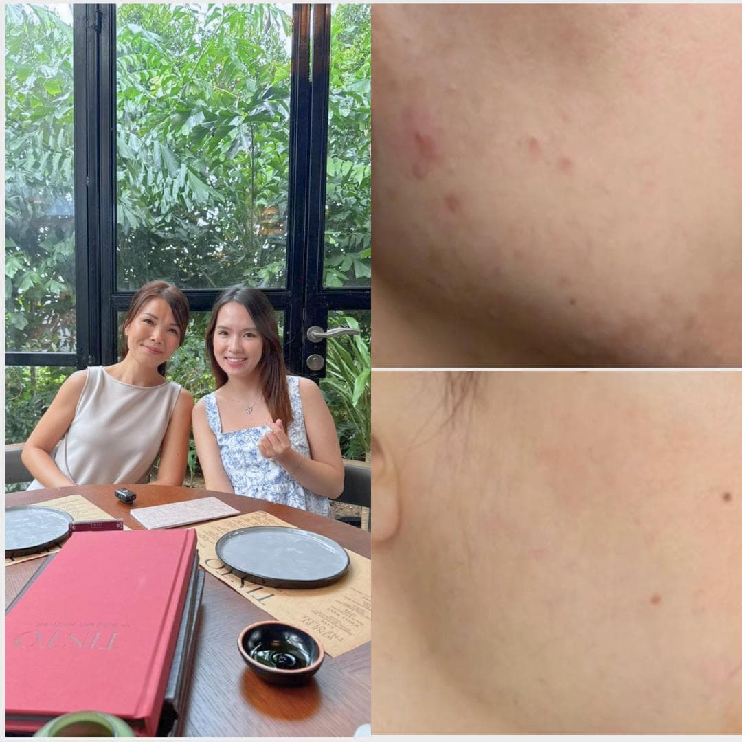 Jane — before and after using Femoire